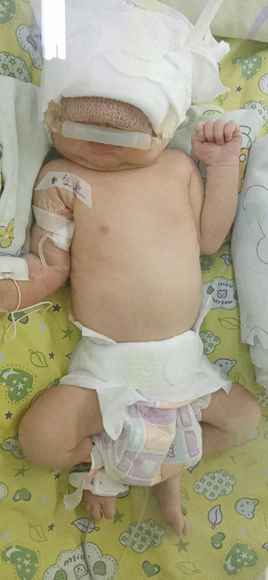 第二次也为阴性！重庆首例新冠肺炎孕妇临盆女婴还需最后一次检测，加油！