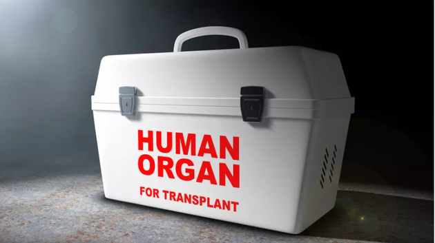 器官移植者生前需要具备哪些硬性条件？