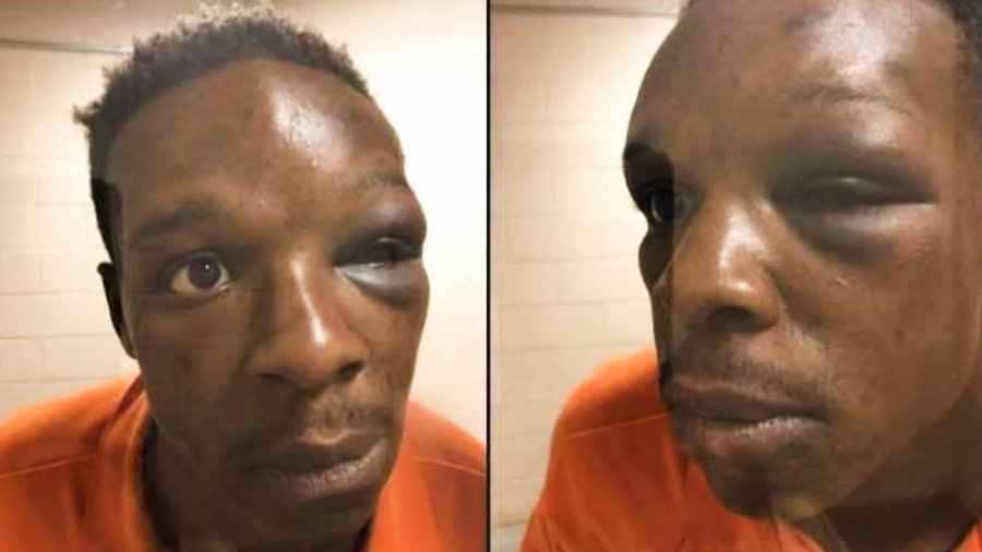 美国警方暴力法律事件再产生 非裔男人被殴打致昏倒