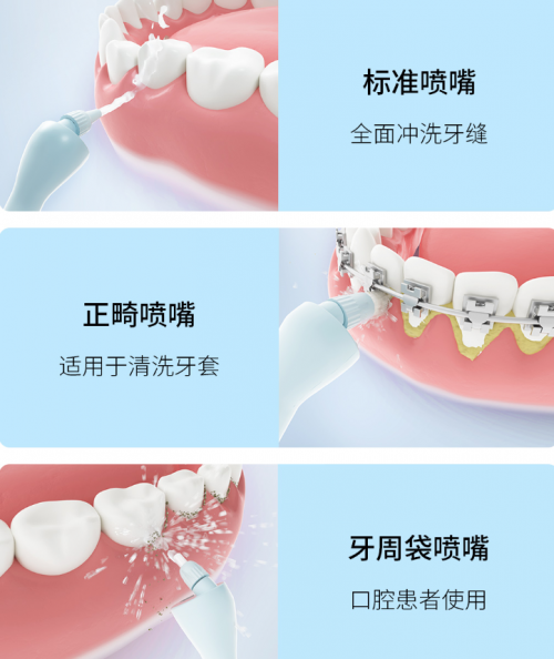 正畸人士福音！素诺智能可视冲牙器C3 pro看得清，冲