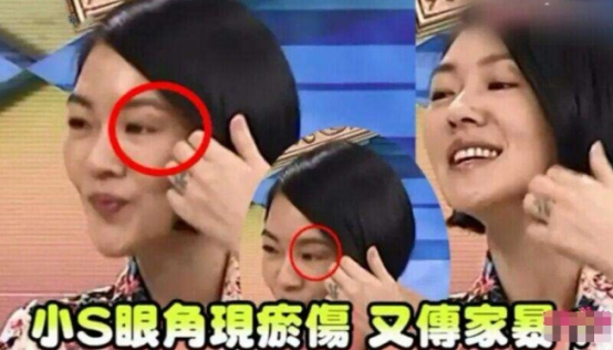 屡传被家暴戴绿帽 为何小S对待感情做不到大S的雷厉风行