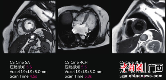 南溪山医院高端科研型磁共振Ingenia 3.0T CX正式投用