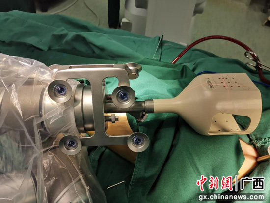 南溪山骨科手术机器人正式“上岗” 完成桂林首秀